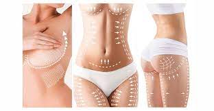 Miami Beach Beauty: Transform Your Tummy with Abdominoplasty
